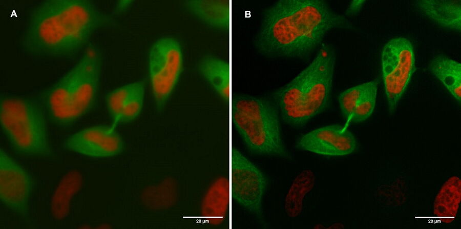 A) Standard WF Image of cells of interest, imaged with green and red fluorescence channels. B) Data post-processed with THUNDER Small Volume Computational Clearing.