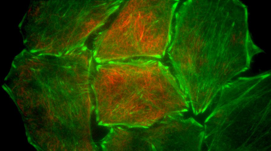 [Translate to italian:] Hela cells stably expressing Actin Chromobody-Tag GFP2 and stained with SIR-Tubulin. Courtesy of ChromoTek GmbH, Munich, Germany, and Spirochrome S