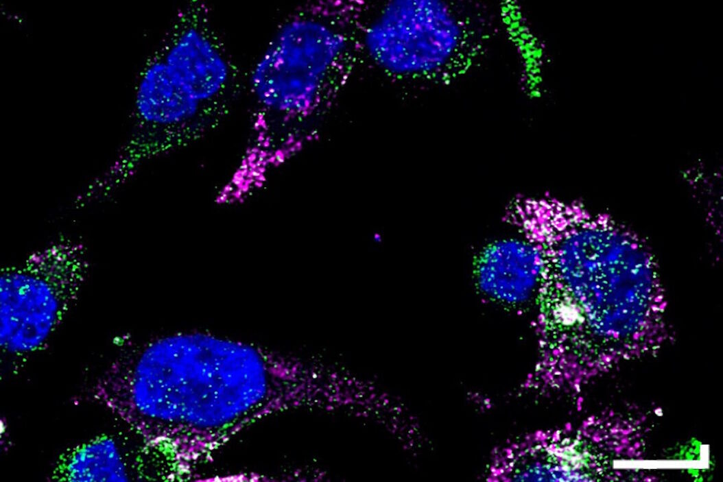 GLP-1 and PYY localized to distinct secretory pools in L-cells. L-cells.jpg