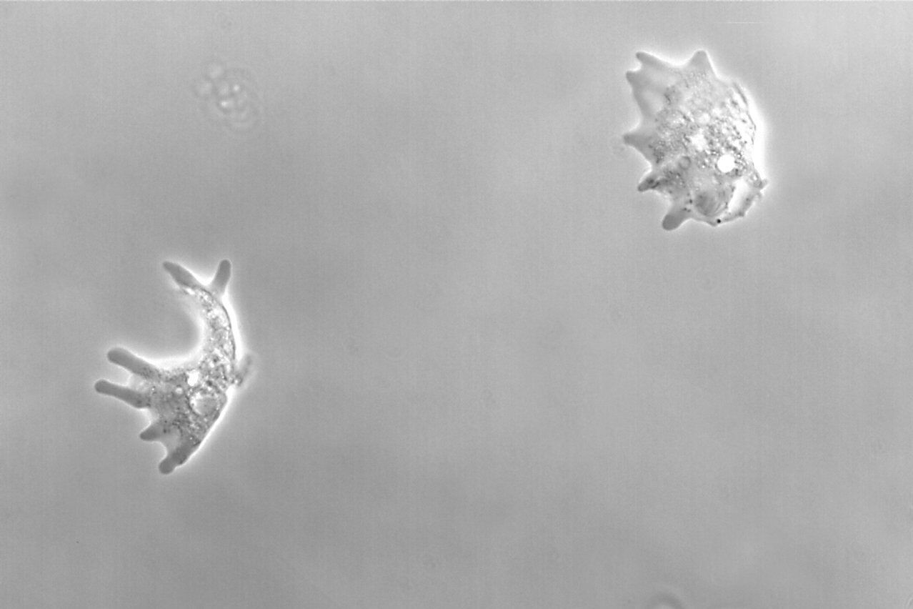 Abbildung 2: Bilder von Amoeba proteus, einem einzelligen Organismus, aufgenommen mit Phasenkontrast und Hellfeld.