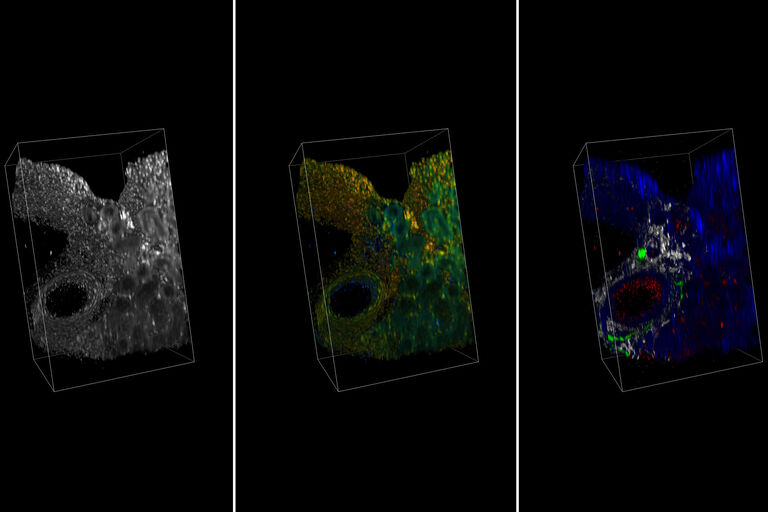 Coupe de rein clarifiée avec RapidClear et imagée en microscopie multiphoton. La première image est l’intensité, la deuxième TauContrast (excitation 850 nm) et la troisième provient de quatre canaux spectraux où le rouge indique les vaisseaux sanguins (excitation AF488, 920 nm), le collagène est en gris (SHG), les cellules nerveuses sont en vert (excitation SytoxOrange, 1 040 nm) et les noyaux en bleu (excitation AF633, 1 100 nm). Avec l’aimable autorisation de SunJin Labs.