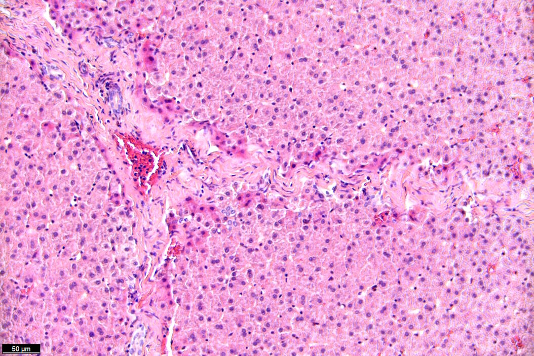 Brightfield image of a pig liver stained with hematoxylin-eosin (HE). Pig_Liver_BF_stained_with_hematoxylin-eosin.jpg