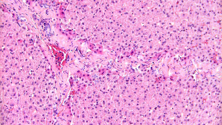 Brightfield image of a pig liver stained with hematoxylin-eosin (HE).