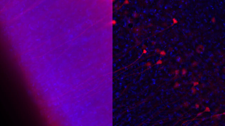 Influenca in lung epithelial cells (porcine) - THUNDER Imager 3D Cell Culture Influenca virus – red, cilia – green, Nuclei – blue.