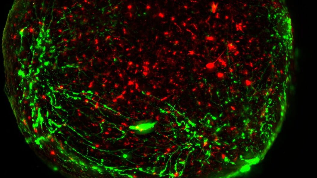 Virally labeled neurons (red) and astrocytes (green) in a cortical spheroid derived from human induced pluripotent stem cells. THUNDER Model Organism Imager with a 2x 0.15 NA objective at 3.4x zoom was used to produce this 425 µm Z-stack (26 positions), which is presented here as an Extended Depth of Field (EDoF) projection.  Images courtesy of Dr. Fikri Birey  from the Dr. Sergiu Pasca laboratory at Stanford University, 3165 Porter Dr., Palo Alto, CA Neural-sphere_model-org_LVC.jpg