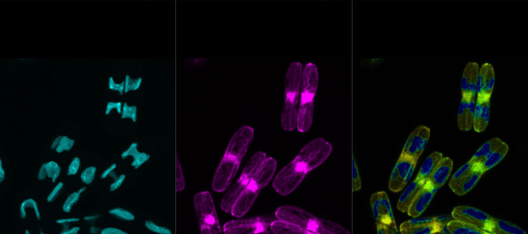 Diatomeen untersucht mit TauSense Bildgebungstools. TauSeparation: Bild links: Lebensdauerkomponente 1 Ausschneiden der Autofluoreszenz der Chloroplasten, durchschnittliche Ankunftszeit der Photonen 1 ns. Bild Mitte: Lebensdauerkomponente 2 zeigt das saubere LifeAct-GFP-Signal von Aktin-Filamenten, 2,7 ns durchschnittliche Ankunftszeit. Das rechte Bild zeigt TauContrast: Die Lookup-Tabelle zeigt die Ankunftszeiten farblich an: kurze Ankunftszeiten in blau, längere Ankunftszeiten in gelb bis rot. Proben mit freundlicher Genehmigung von Nicole Poulsen, B CUBE, TU Dresden, Deutschland.