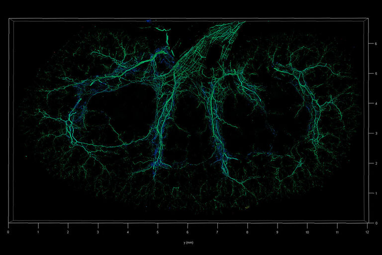 Coupe de rein (SunJin Labs, nettoyée avec RapidClear) imagée par LAS X Navigator et TauContrast. Une tranche entière de 10 x 7 mm et 500 µm d’épaisseur. Des temps d’arrivée plus courts en bleu représentent le collagène (signal SHG), tandis que des valeurs plus longues en vert représentent les cellules nerveuses colorées avec Alexa 633.