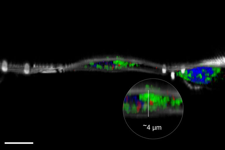 Säugetierzellen mit Hoechst (blau, Nucleus), Mitotracker Green (grün, Mitochondrien), Bodipy (rot, Lipidtröpfchen), Perlen (magenta, 1 μm), Reflexion (weiß). Maßstab 10 μm: Zellen freundlicherweise bereitgestellt von Ievgeniia Zagoriy, Mahamid Group, EMBL Heidelberg, Deutschland
