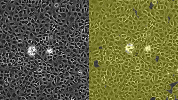 Image of confluent cells taken with phase contrast (left) and analyzed for confluency using AI (right).
