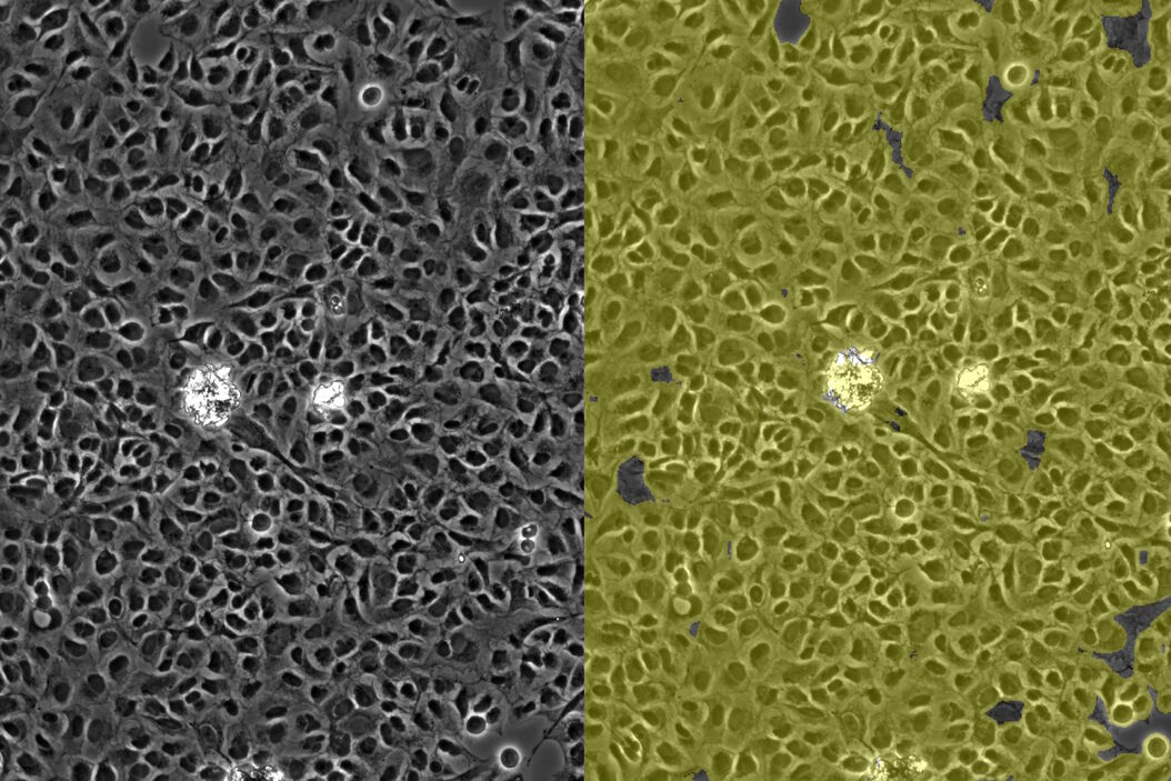 Image of confluent cells taken with phase contrast (left) and analyzed for confluency using AI (right). Confluent_cells_with_phase_contrast_and_analyzed_for_confluency_using_AI.jpg