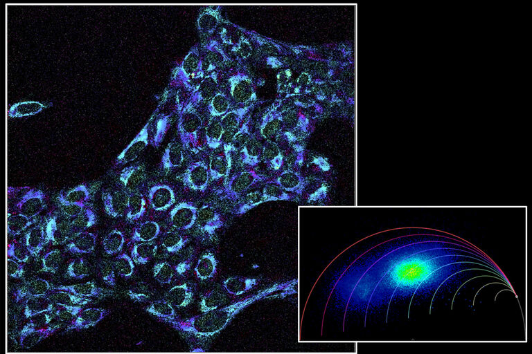 Imagen sin marcadores de NADH en células mamíferas vivas con STELLARIS DIVE FALCON. La información sobre el tiempo de vida de la fluorescencia del NADH ofrece una visión del estado metabólico de la célula. El enfoque phasor-FLIM y la trayectoria metabólica codificada por colores permiten una visualización inmediata del estado de fosforilación oxidativa (rojo, tiempo de vida más largo, NADH ligado) y del estado glucolítico (amarillo, tiempo de vida más corto, NADH libre) de las células.