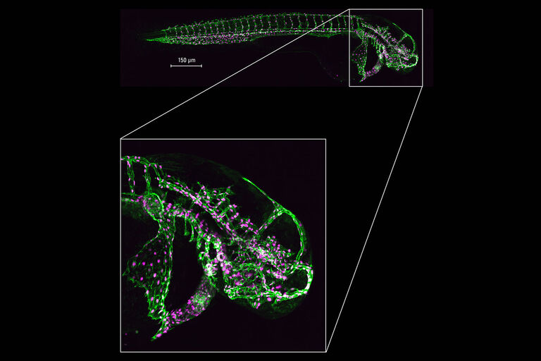 Imagerie haute résolution de grands spécimens entiers: L’option de balayage en mosaïque permet l’imagerie complète de grands spécimens, comme l’embryon entier de poisson-zèbre montré ici, à haute résolution. Avec l’aimable autorisation d’Elvire Guiot, Centre d’imagerie de l'IGBMC à Illkirch-Graffenstaden, France et de Julien Vermot, Imperial College à Londres, Royaume-Uni.
