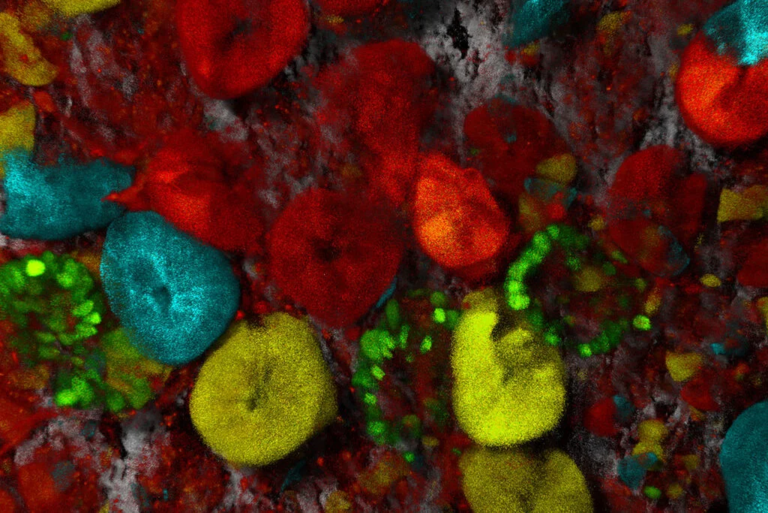 Intestinos de un ratón Confetti: El colágeno1 se muestra en gris (SHG sin marcaje) y las células madre trazadas por linaje se muestran en cian, verde, amarillo y rojo. Las células madre juegan un papel importante en la propagación del cáncer dentro de los organismos. Muestra cortesía de Jacco van Rheenen, Netherlands Cancer Institute, NL.