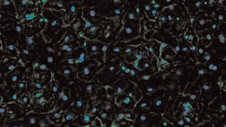 SPERM HY-LITER™ staining of a sexual assault smear slide which was performed by a forensic DNA crime laboratory.