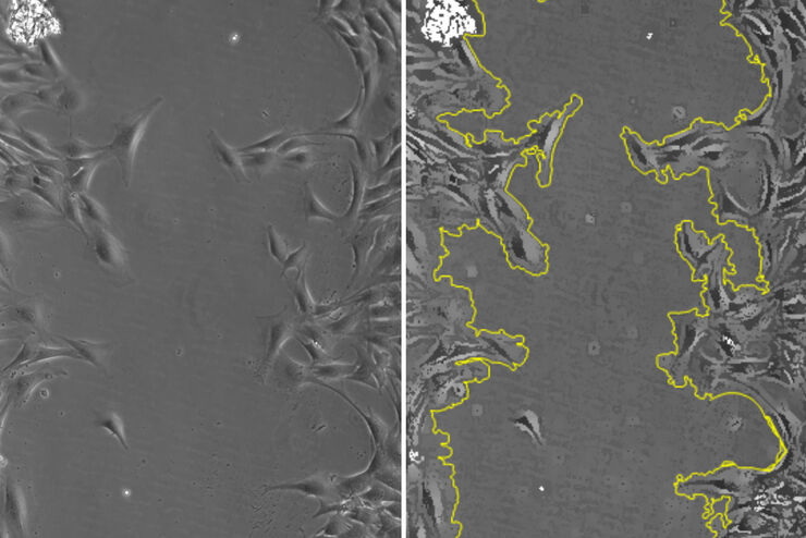 Images of smooth muscle cells during wound healing. Courtesy L.S. Shankman, Ph.D., University of Virginia.