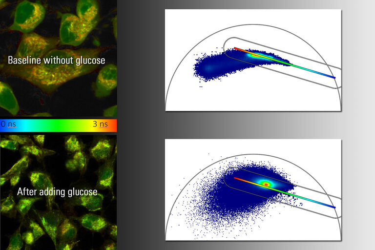 Autofluorescence du NADH des cellules HeLa cultivées avant et après traitement au glucose. À gauche : Gauche : résultat qualitatif avec TauContrast. À droite : Droite : analyse quantitative à l’aide de la représentation en phasor dans FALCON.