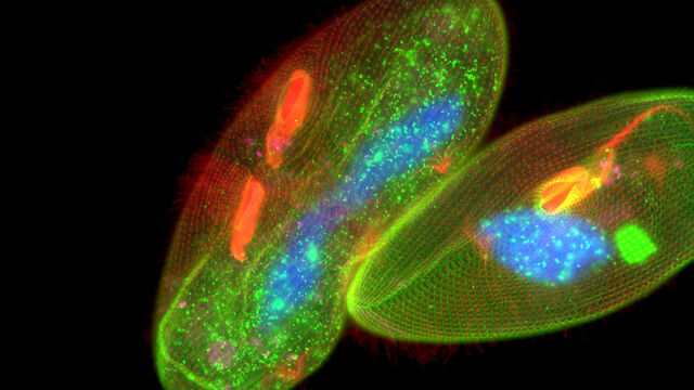 Microscopes pour la recherche en sciences de la vie