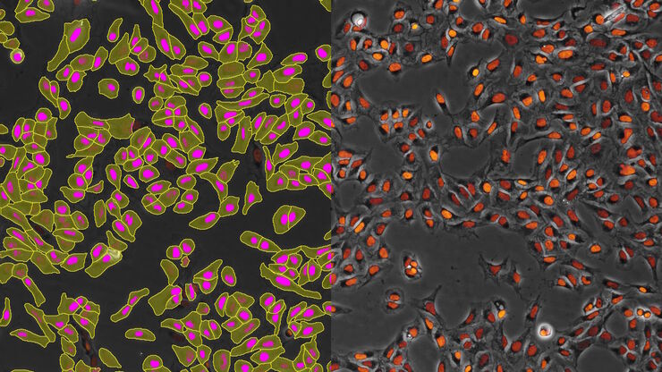 AI-based transfection analysis (left) of U2OS cells which were transfected with a fluorescently labelled protein. A fluorescence image of the cells (right) is also shown. The analysis and imaging were performed with Mateo FL.