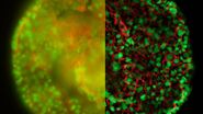 HeLa cell spheroid stained with Alexa Fluor 568 Phalloidin (Actin) and YOYO 1 iodide (Nucleus).