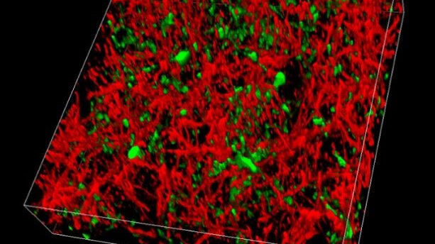 Effortless separation of GFP (green) and YFP (red) expressed in the cortex of a live mouse by capturing either two channels simultaneously or conducting a spectral emission scan and applying channel unmixing in the LAS X software.