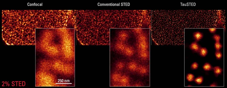 세포생물학을 위한 STED: TauSTED 660은 AF555와 Nup 복합체에 대해 면역염색된 COS7 세포 상의 핵 기공(NPC)의 분포를 나타냅니다. STED 조명의 2%만으로도 더 자세한 디테일을 보여줍니다. 1차 항체 mAb414는 핵공의 일부 뉴클레오포린을 인식하고, 반점 같은 염색을 생성합니다.