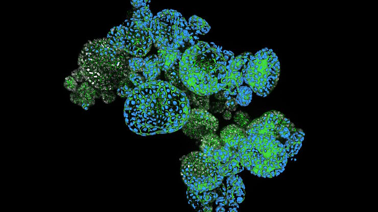 Dapi – Nucleus, GFP – Plasma Membrane, Thickness 100µm, 63x objektive, 469 Z planes, 2 channels, THUNDER Imager 3D Cell Culture. Courtesy M.Sc. Dana Krauß, Medical University of Vienna (Austria).