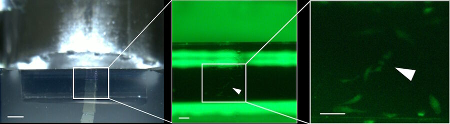 Figure 10: Visualization of target cells during the sectioning. Left: Overview picture of the knife edge and boat with the first sections. Scale bar 500 µm. Middle: Fluorescence observation on the 8th section: One can see the knife edge and two strong autofluorescent strips by the knife. In between the section (100 nm) and the target cells under fluorescence are visible. Scale bar: 100 µm Right: Magnification and cropping of the same image. The target cells are indicated by the white arrow. Scale bar: 100 µm.