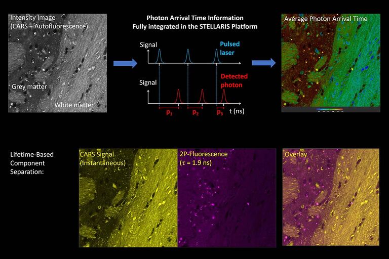 Superior izquierda: Imagen de microscopio CARS de lípidos en un tejido cerebral, con regiones de materia blanca rica en lípidos y materia gris. Superior derecha: La imagen del tiempo medio de llegada de los fotones revela tiempos de llegada más cortos a partir de la materia blanca rica en lípidos y tiempos de llegada más largos a partir de la materia gris. Este resultado indica que las señales de CARS instantáneas van acompañadas de señales de autofluorescencia de 2 fotones con un teimpo de vida finito. Fila inferior: Separación basada en el tiempo de vida de las señales instantáneas de CARS y las señales de autofluorescencia con un tiempo medio de llegada de 1,9 ns. Derecha: Superponer imagen.