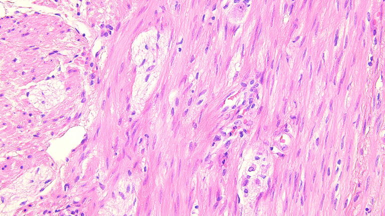 H&E staining image