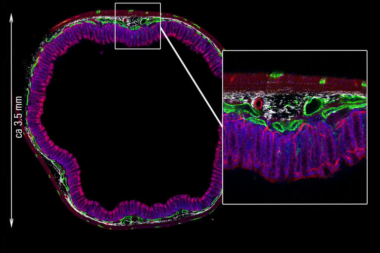 Sección de intestino, 3.5 mm de diámetro, clarificada con RapidClear y adquirida con Navigator: B/N: SHG – colágeno; Azul: Sytox Orange – núcleos; Verde: Alexa 633 – células nerviosas; Rojo: Alexa 488 – vasos sanguíneos.
Muestra cortesía de SunJin Labs.