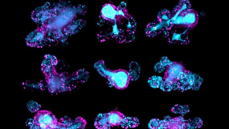 67-hour, multi-position time-lapse of mouse intestinal organoids expressing the cell cycle reporter FUCCI2 (hGem-mVenus and hCdt1-mCherry). 67-hour, multi-position time-lapse of mouse intestinal organoids expressing the cell cycle reporter FUCCI2 (hGem-mVenus and hCdt1-mCherry).