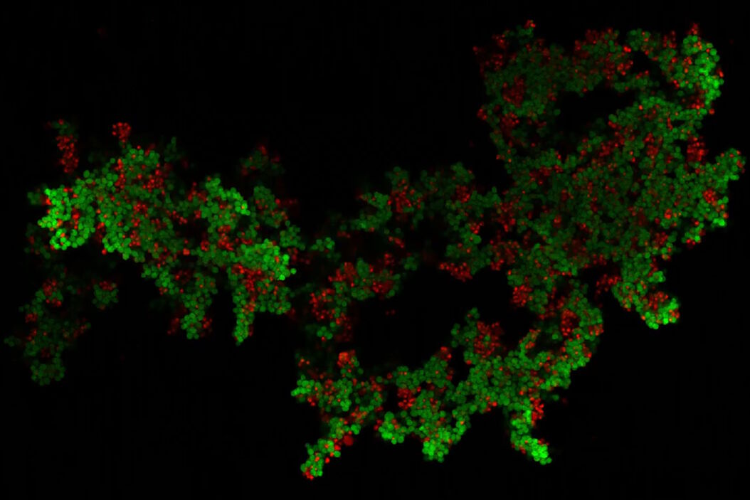 3D culture of ovarian cancer cells imaged using the confocal mode of Mica. 3D_culture_of_ovarian_cancer_cells.jpg