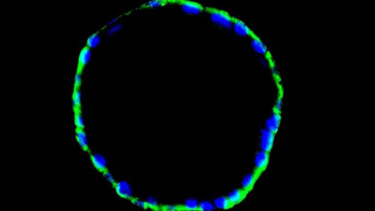 Immunofluorescence image of a mouse enodmetrial organoid stained with CK14 and DAPI Immunofluorescence image of a mouse enodmetrial organoid stained with CK14 and DAPI