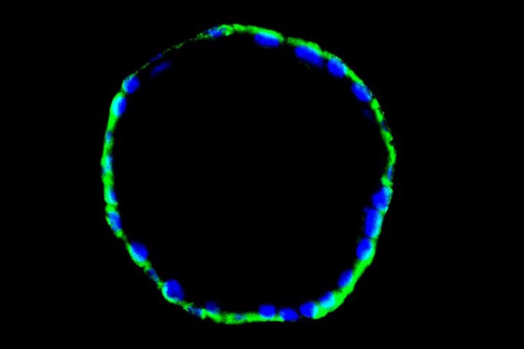 Immunofluorescence image of a mouse enodmetrial organoid stained with CK14 and DAPI Immunofluorescence_image_of_a_mouse_enodmetrial_organoid_stained_with_CK14_and_DAPI.jpg