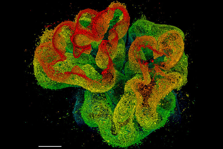 Imágenes STED y ADN origami: la línea TauSTED 775 proporciona resoluciones <30nm en GATTA-Bead R cuyo tamaño nominal es de 23nm. Barra de escala: 1 µm.