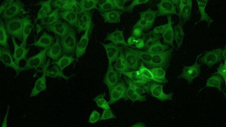 Fluorescence 20x de cellules HeLa