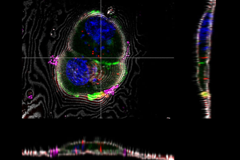 LAS X Coral Cryo: Interpolation based targeting in 3D using sections through the z-stack in x and y direction. The markers can be moved interactively in all relevant windows.