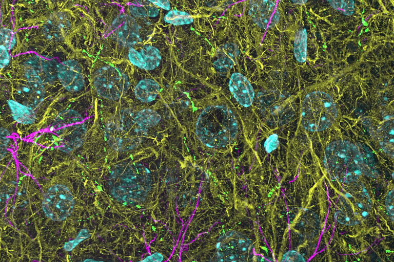 3D THUNDERed spinning disk image of a 200 µm thick mouse brain