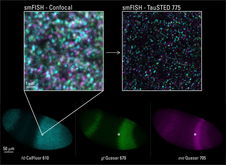 発生生物学におけるSTED実用例：ショウジョウバエ胚ホールマウント試料におけるRNAのsmFISH*。直接標識プローブを使用。シグナル増強なし。上段: TauSTED 775 による 3重染色像、hb CalFluor 610(シアン)、gt Quasar 670(緑色)、eve Quasar 705(マゼンタ)。下部：ショウジョウバエ胚ホールマウントの共焦点イメージング。サンプル提供：英国マンチェスター大学、Tom Pettini博士。
* 単一分子in-situハイブリダイゼーション