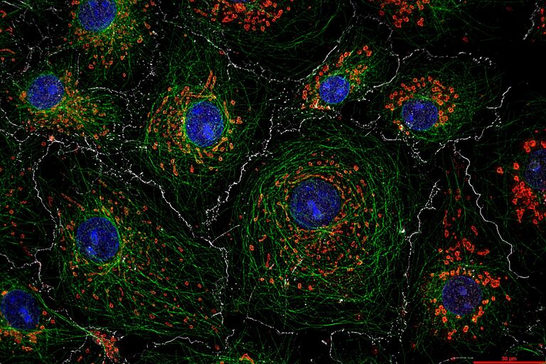 Image THUNDER de cellules COS7 avec coloration DAPI (noyaux), anticorps anti-tubuline et Mitotracker* (mitochondries) et cadhérine E. Échantillon avec l’aimable autorisation du professeur Ralf Jacob, Université de Marbourg, Allemagne