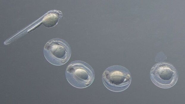 Hatching zebrafish 48hpf in Rottermann Contrast. Sample courtesy: Vermot Laboratory, IGBMC Strasbourg, France