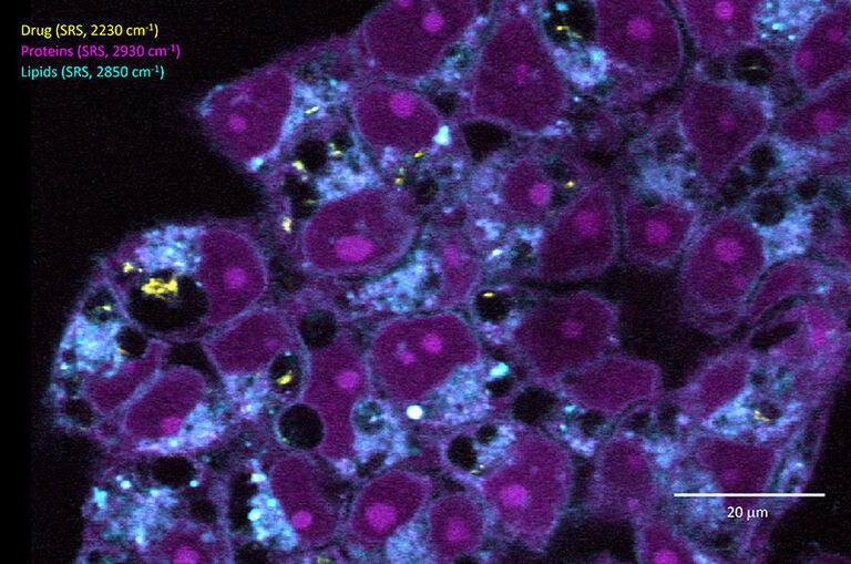 Die mehrfarbige SRS-Bildgebung zeigt die subzelluläre Verteilung einer mit Raman markierten pharmakologischen Verbindung (gelb, SRS-Bildgebung bei 2230 cm⁻¹) im Kontext der endogenen Lipide und Proteine in einer ansonsten nicht markierten zellulären Probe. Probe mit freundlicher Genehmigung von Dr. Matthäus Mittasch, Dewpoint Therapeutics GmbH.