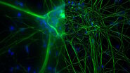 Microscopy for neuroscience research