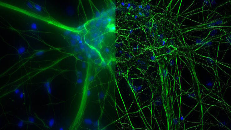 Microscopy for neuroscience research