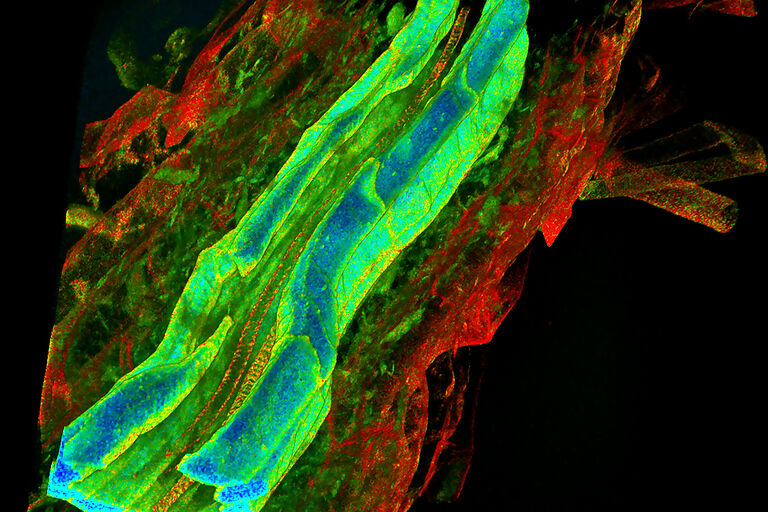 Endogenous fluorescence Average Arrival Time Image (TauContrast) of cleared Arabidopsis thaliana root samples. Courtesy: W. Busch, Salk Institute, La Jolla, CA, USA.