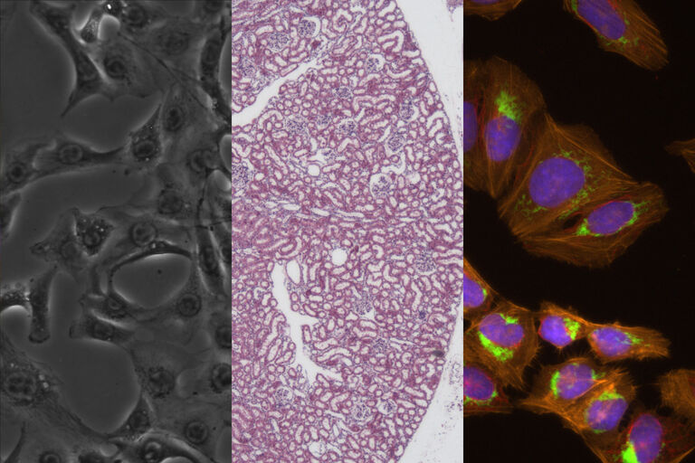 Tudo o que é necessário em uma única plataforma: aquisição de imagens multimodal de fluorescência e de luz transmitida num relance. Contraste de fase - Brightfield - Fluorescência (da esquerda para a direita).