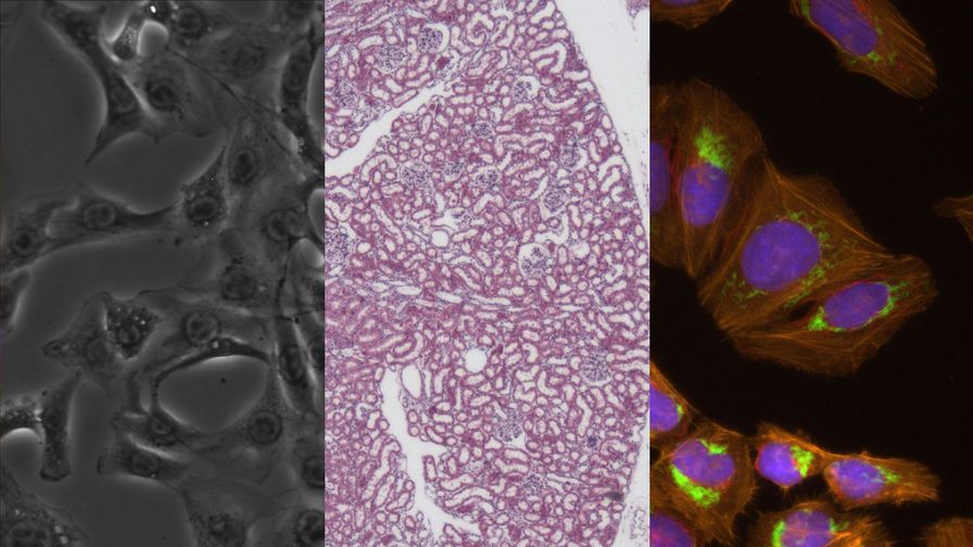 [Translate to korean:] Mateo Multi Modal Imaging