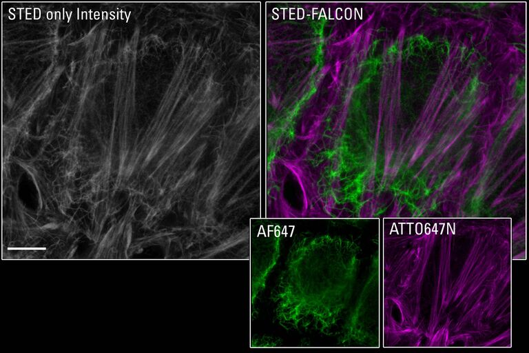 STED-FLIM para biologia celular: A separação de fases automatizada STED 775 e FALCON permite separar espécies com espectros sobrepostos usando seu tempo de vida de fluorescência. Em células HEK marcadas para vimentina e actina, as informações de intensidade da contagem de fótons sozinhas (cinza), mostram ambas as estruturas como indistintas, enquanto elas são claramente distinguidas com STED-FLIM (verde, Vimentina AF647; magenta, Actina ATTO 647N-faloidina). Barra de escala: 4 µm. Amostra de cortesia de Sebastian Hänsch, Stephanie Weidtkamp-Peters, CAI, Düsseldorf, na Alemanha.