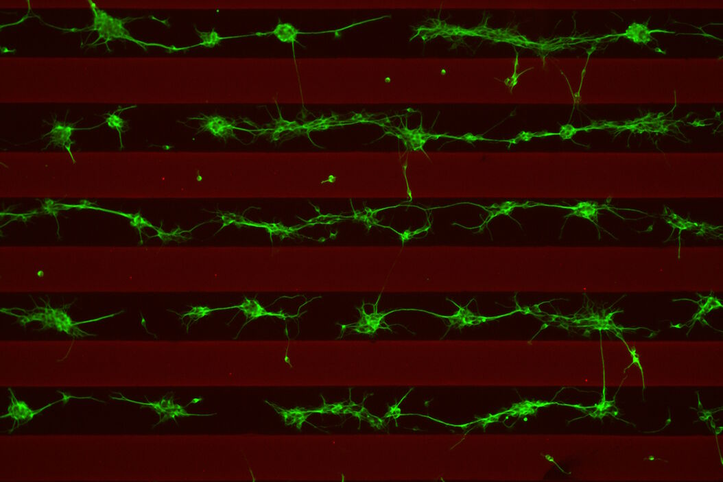 Stripe assay performed on a THUNDER Imager Cell. Courtesy of Maria Carrasquero Ordaz, University of Oxford. Stripe_assay_THUNDER_Imager_Cell.jpg