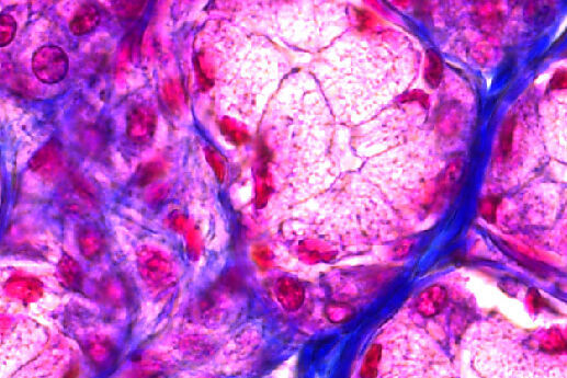 Glándula parótida con tinción H&E tomada con la cámara de microscopio K3 y 12 bits de profundidad.